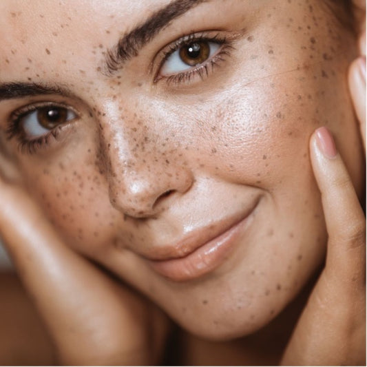 The importance of the Skin Microbiome